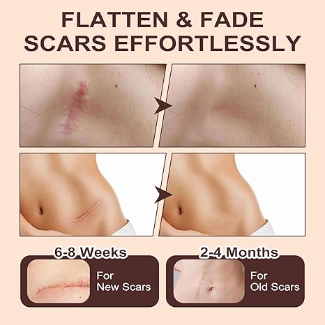 Mediosol™ Epidermal Repair Stick