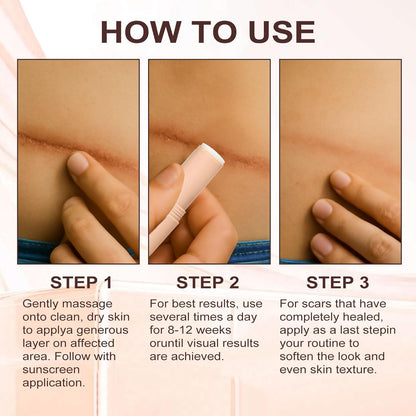 Mediosol™ Epidermal Repair Stick