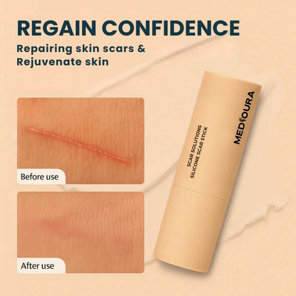 Mediosol™ Epidermal Repair Stick